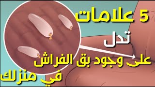 5علامات تدل على وجود بق الفراش في منزلك