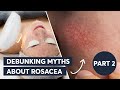 Debunking Myths About Rosacea \ Part 2