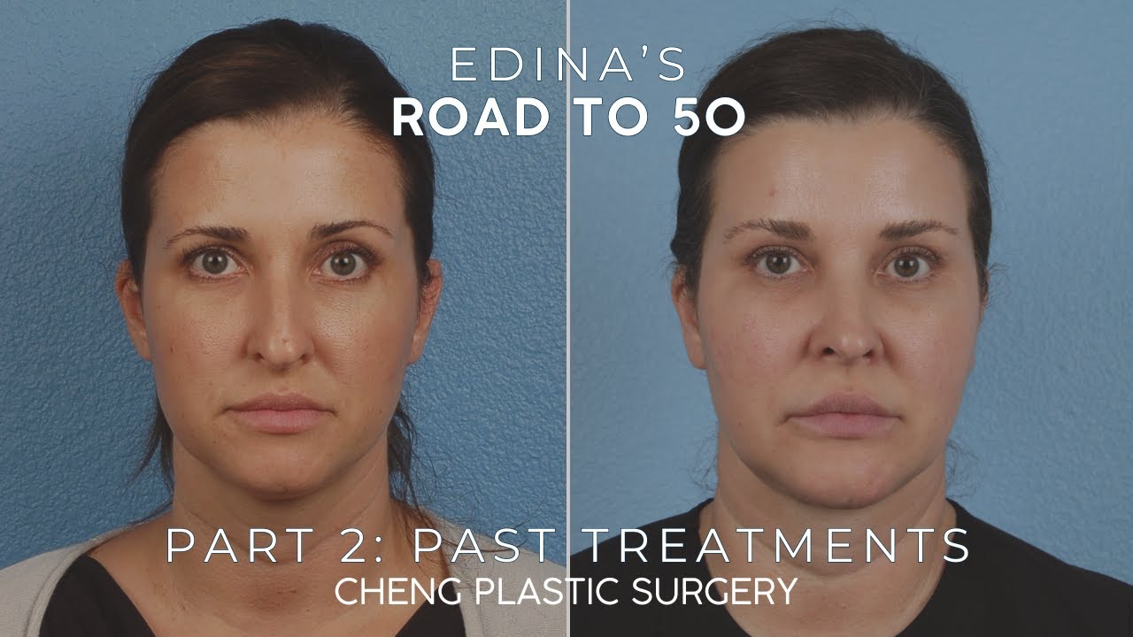 🌟 Road to 50 Part TWO: Every Procedure Edina’s Done 🌟