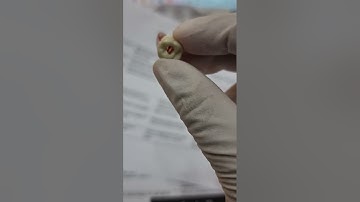 Endo task - My ADC prep journey.