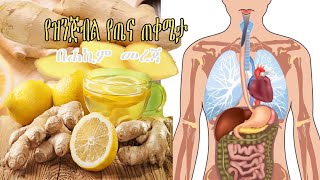ዝንጅብል ለጤናችን ያለው ጠቀሜታ ሀኪም መረጃ