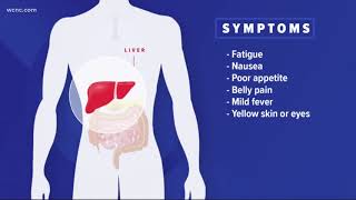 Health department announces new hepatitis A case
