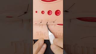 Suturas De Chaleco Sobre Pantalón