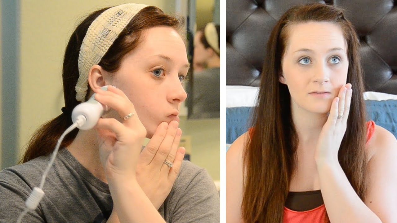 GETTING RID OF ACNE SCARS! - Missy's April Favorites