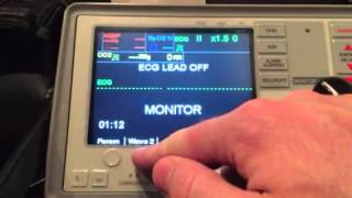 EtCo2 on a ZOLL E Series