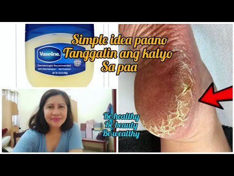 Video: Ano Ang Kalya