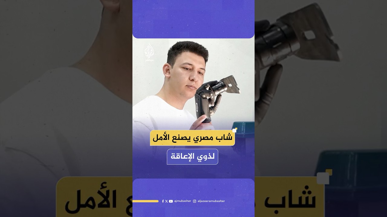 شاب مصري يطور أطرافا صناعية ذكية تعيد الأمل لذوي الإعاقة