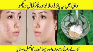 14 Days Dark Spots & Pigmentation Removal Challenge / 100% Results /By Fatima health And Beauty Tips