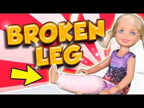 barbie chelsea broke her leg