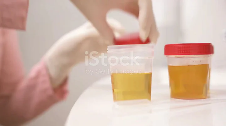 The Best Vitamin for Lower Back Pain (Sciatica)