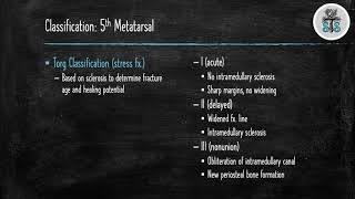 5th Metatarsal Fracture