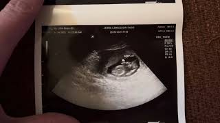 #2 on the way 👨‍🍼