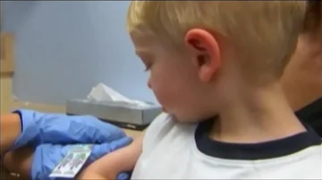 Co jsou nakažlivé nemoci?