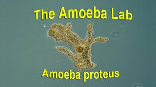 Amoeba Proteus –  Time Lapse & Real time by the Amoeba Lab