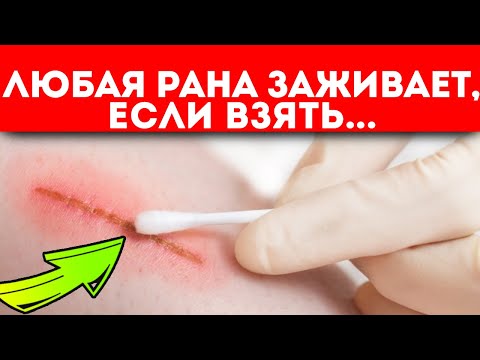 Разок-другой и зажило! Как применить народную медицину и классическую обработку для исцеления ран