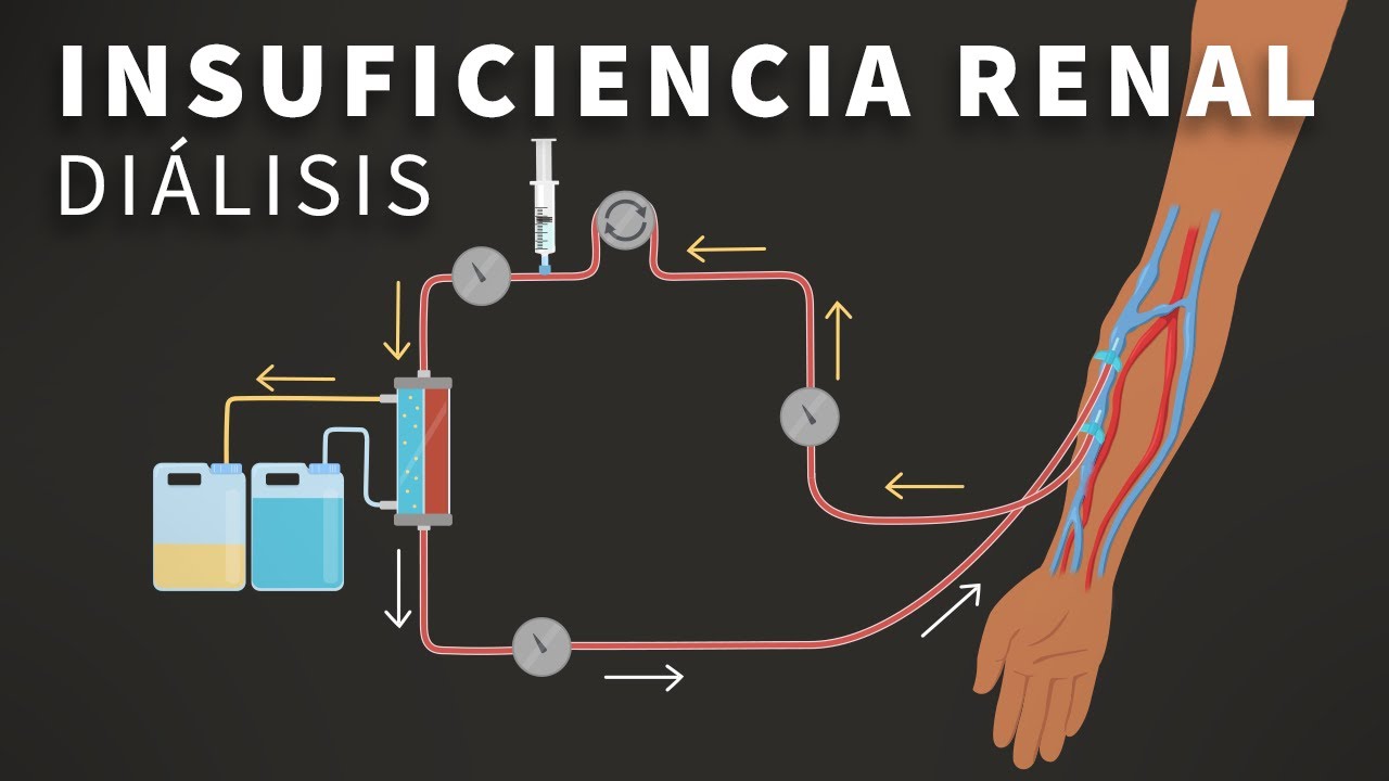 Insuficiencia Renal Terminal y Dialisis