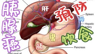 胰腺癌发病原因和饮食建议