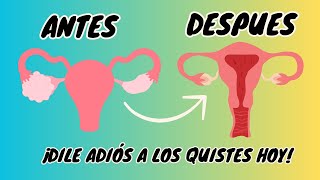 QUISTES en los ovarios TRATAMIENTO Tratamiento quistes OVARICOS