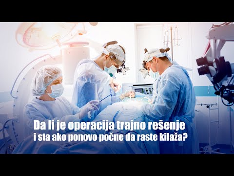 Video: Šta je operacija I?