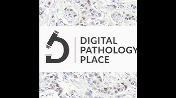 39: How image analysis and artificial intelligence support digital pathology-enabled precision me...
