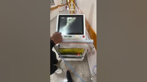 X ray Portable DR System