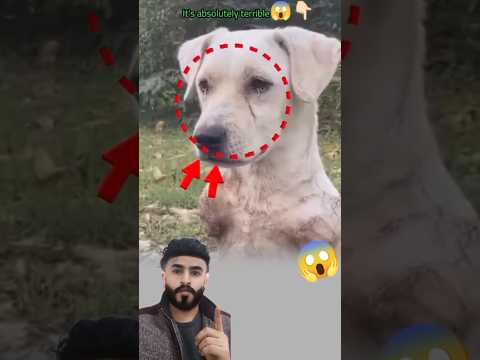 سلبوا منه أطرافه لكنهم لم يستطيعوا سلب الوجع من عينيه   رحمة 