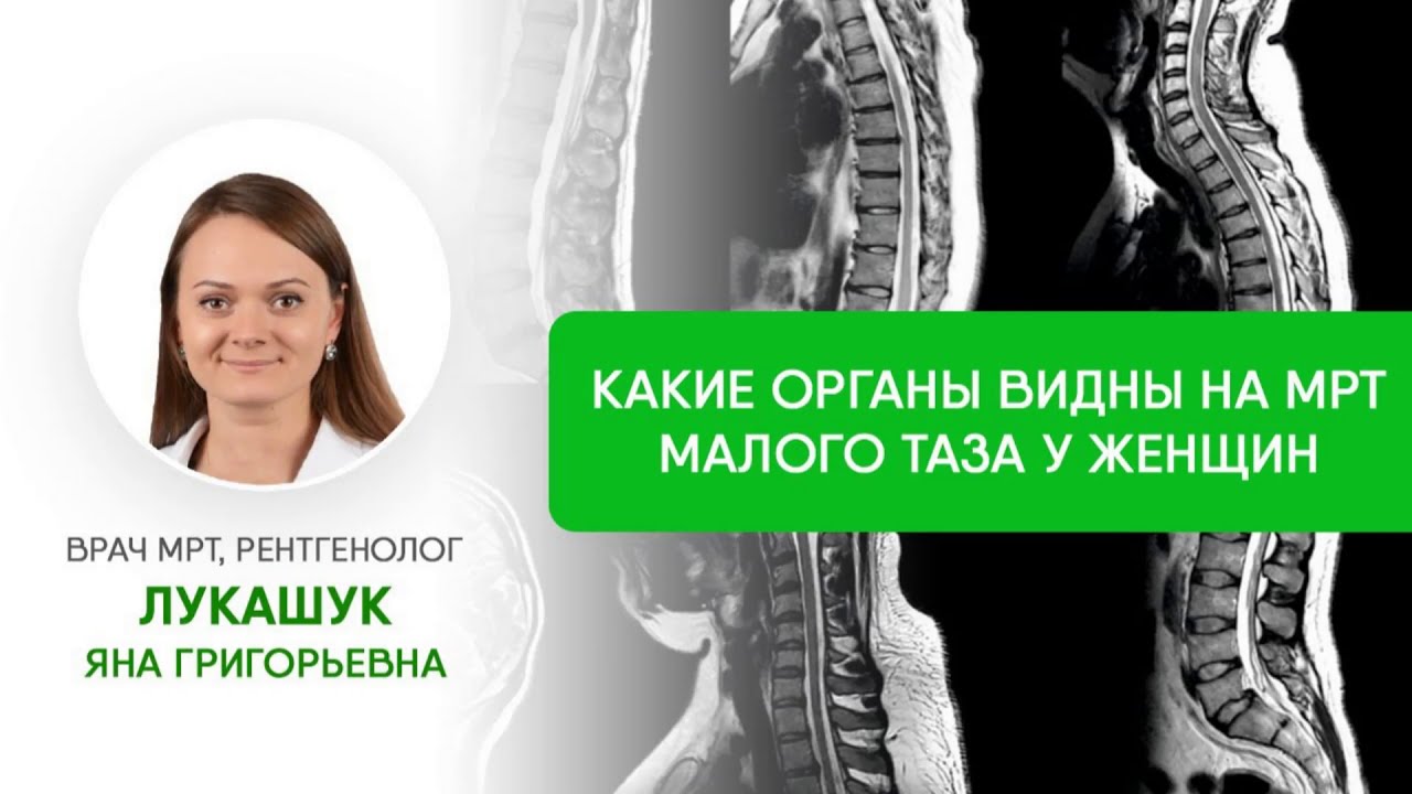 Что покажет МРТ малого таза у женщин