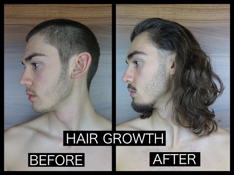 HAIR GROWTH TIME LAPSE - SIDE