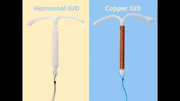 Insertion of intrauterine device CPT code - simplify medical coding