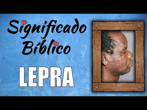 Video: ¿Quién es un leproso en la biblia?