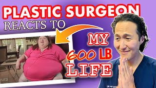 Doctor Reacts to MY 600 LB LIFE: Can She Overcome EMOTIONAL EATING and Food ADDICTION?