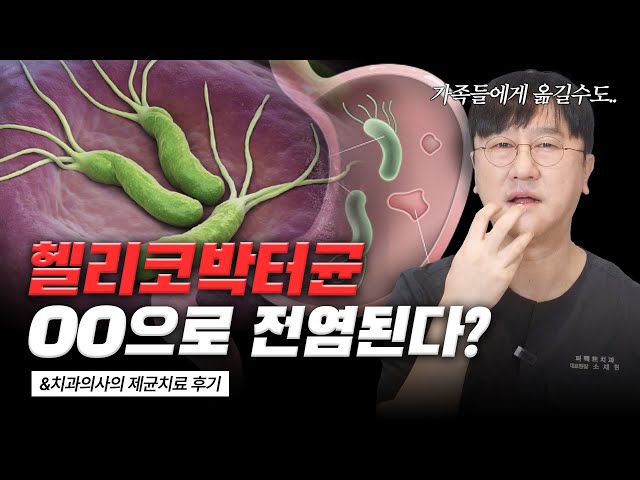 위암까지 이어질 수 있는 헬리코박터균, OO을 통해 전염?🙊｜치과의사가 직접 받아본 제균치료 후기