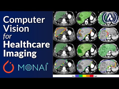 PyTorch and Monai for AI Healthcare Imaging – Python Machine Learning Course