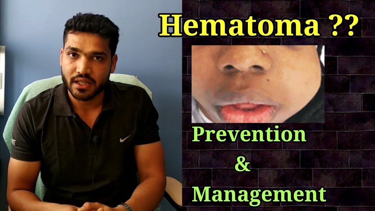 Hematoma (PSA Complication) Prevention & Management YouTube