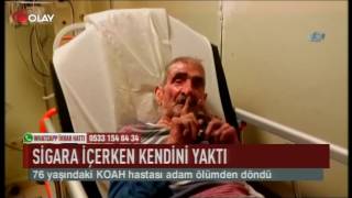 Sigara içerken kendini yaktı (Haber 06 06 2017)