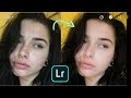 LIGHTROOM Mobile Tutorial - How to remove pimples/acne | Clear face by LIGHTROOM Mobile