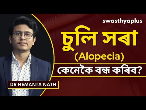 এলোপেচিয়া এৰিয়েটা: কাৰণ আৰু চিকিৎসা  | Alopecia Areata: How to Treat? Assamese | Dr Hemanta Nath