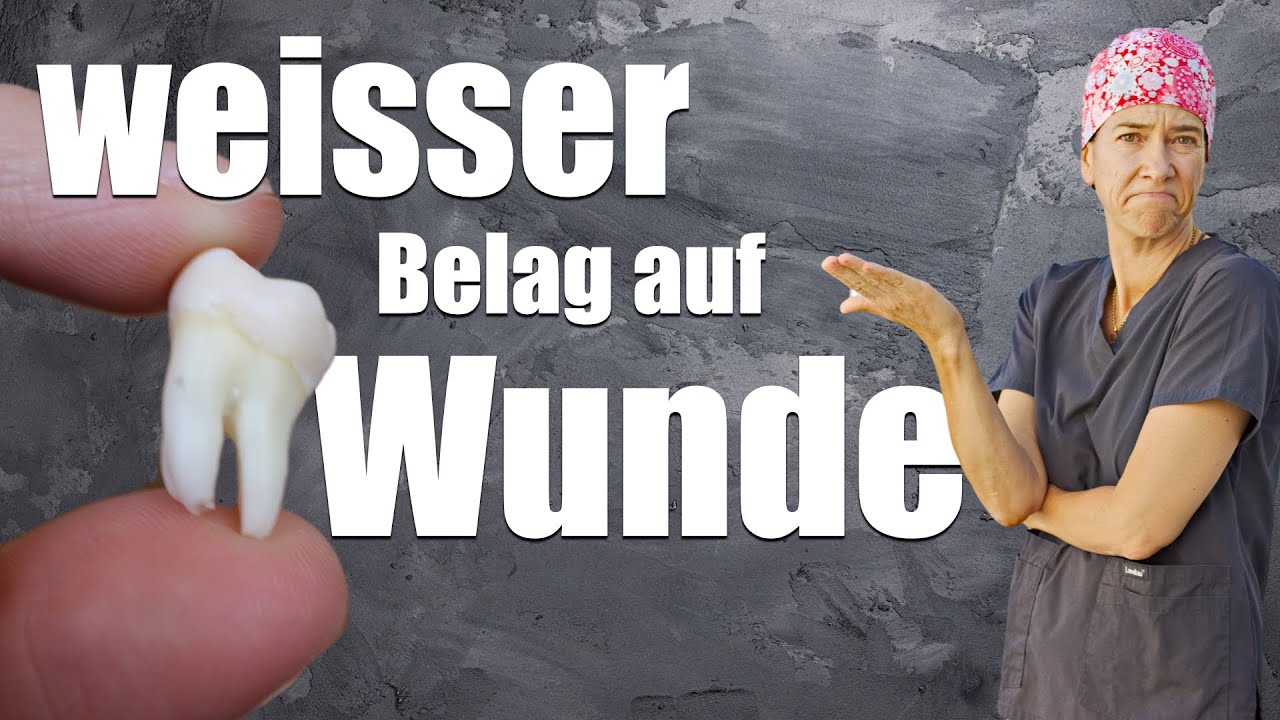 Weisser Belag auf der Zahn-WUNDE: ist das SCHLIMM? WAS ist das
