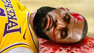 NBA Players Who ALMOST DIED