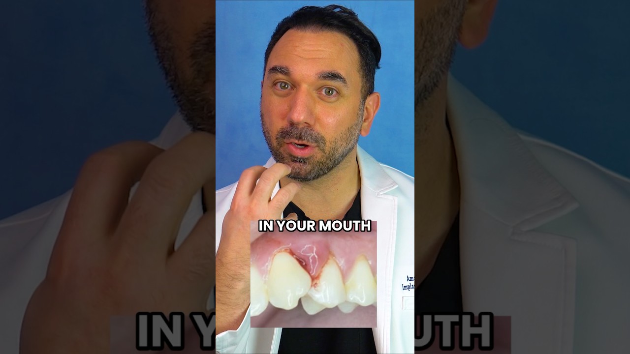 This Tooth Problem Stops Orthopedic Surgeons In Their Tracks #facts #teeth