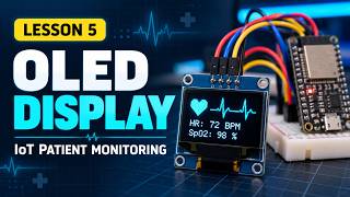 Using an OLED Display with ESP32 | IoT Patient Monitoring System | Lesson 5