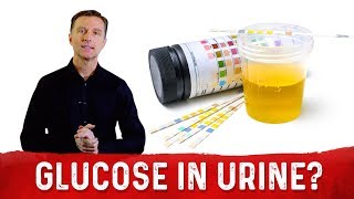 Dangers of Glucose In Your Urine – Dr.Berg