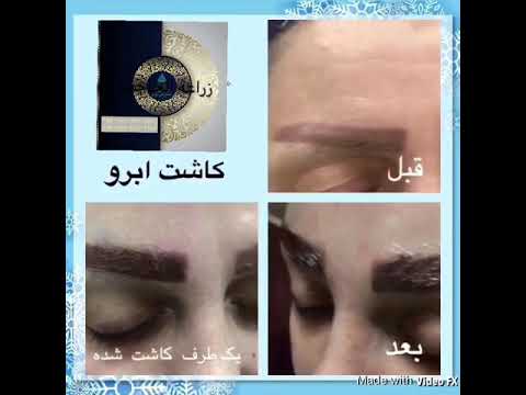 زراعة الحاجب في ايران مشهد وطهران وشيراز افضل اطباء زراعة الشعر والحاجب والشنل شارب واللحية وصدر 