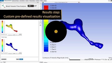 ANSYS ACT Global Update ANSYS 17