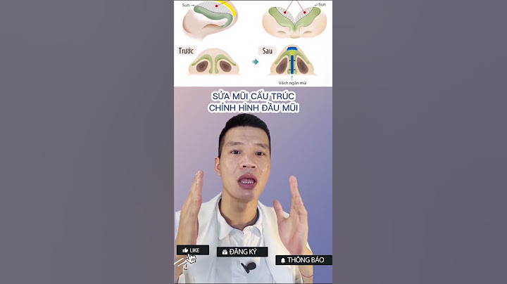 Mũi diều hâu là mũi như thế nào năm 2024