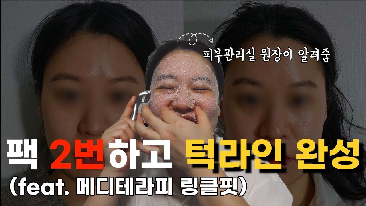 [통장지킴이] EP.1 내돈내산 메디테라피 링클핏ㅣ극강의 리프팅 효과보기