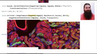 Stitching Microscopy Images with Built-in Wolfram Language Functions (Computational Xplorations)