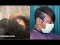 Alopecia Cover up Style| Alopecia Transformation |