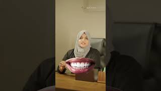 Braces ഊരിയാൽ ഒറ്റ കമ്പി വേണോ? 😬✨ | Why You NEED Retainers After Braces