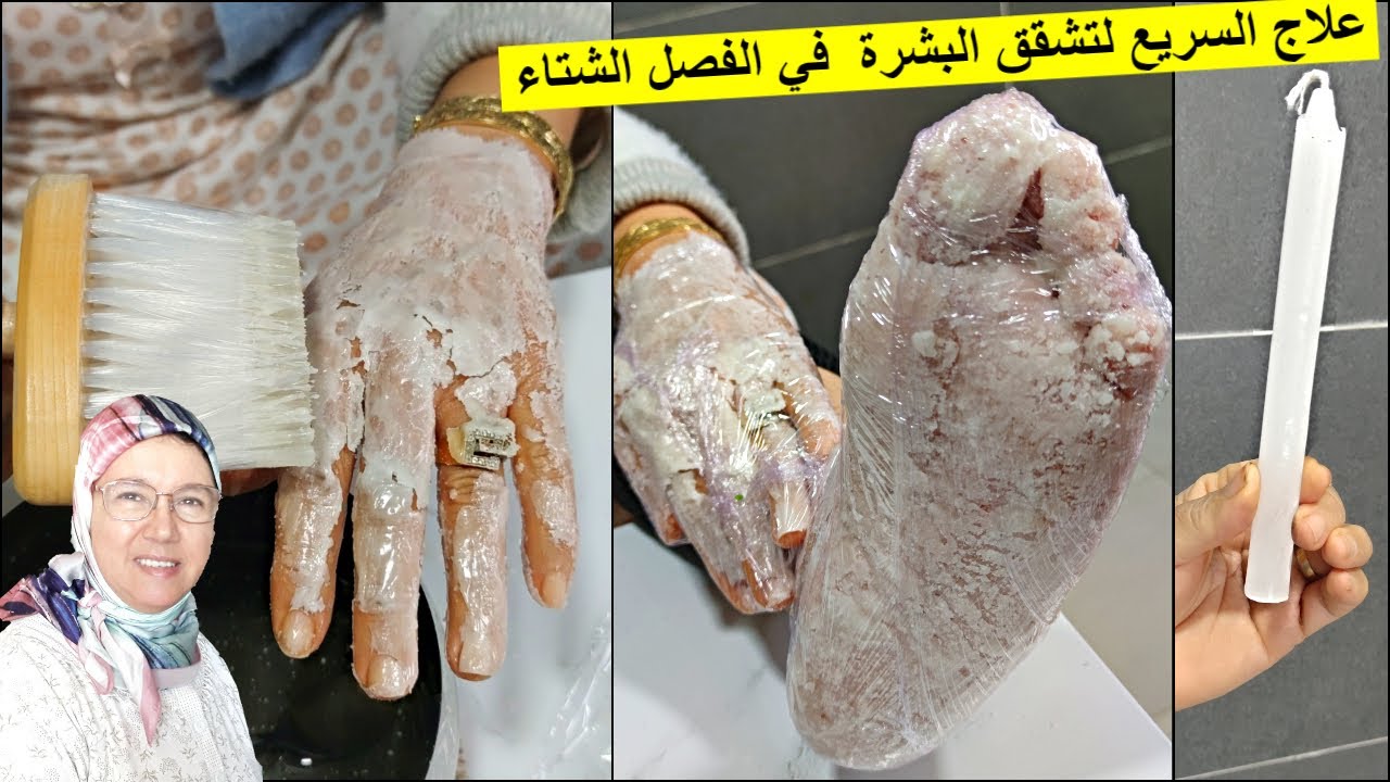 ضعيها لقدميك قبل النوم العلاج السريع لتشقق اليدين أو جفاف اليدين و الأقدام مع الحاجة فاطمة